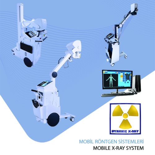 MOBILE X-RAY SYSTEM